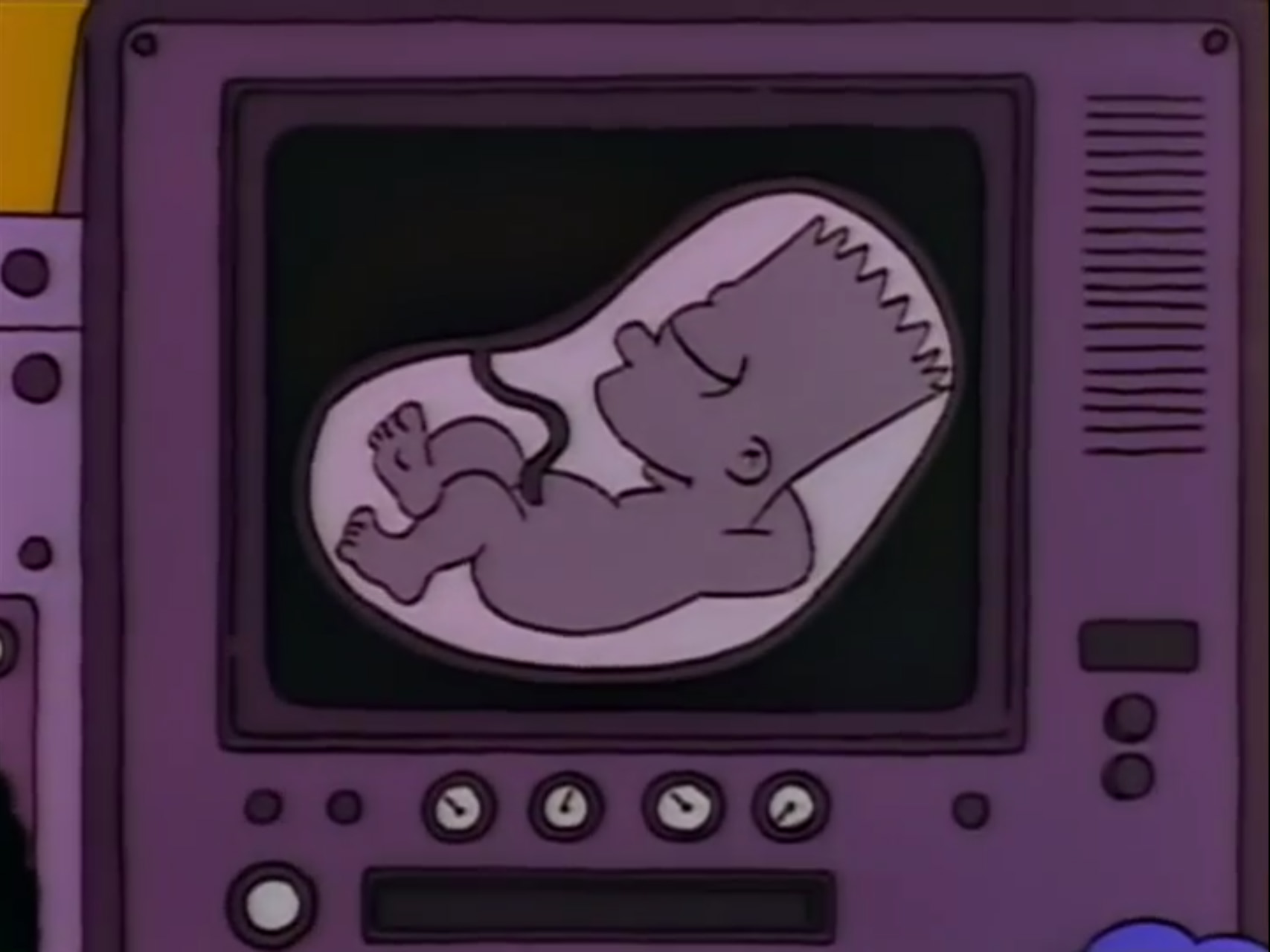 Bart Simpson in the womb